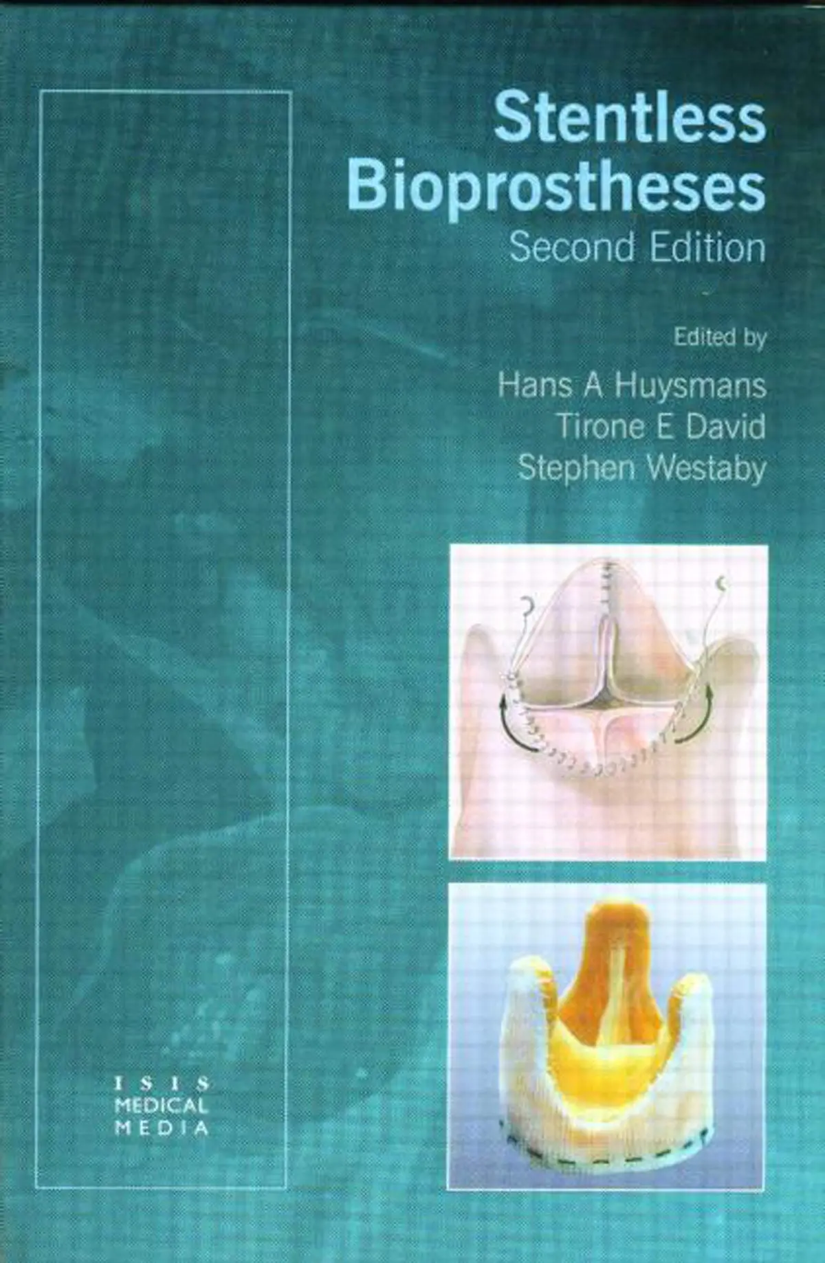 Stentless Bioprostheses [Hardcover] David, Tirone E; Huysmans, Hans A And Westaby, Stephen 1